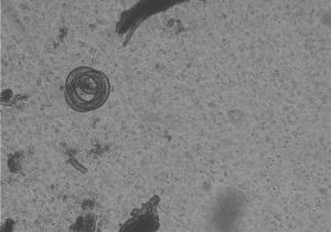 Trichinenlarve durch ein Mikroskop vergrößert