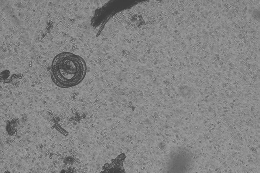 Trichinenlarve durch ein Mikroskop vergrößert